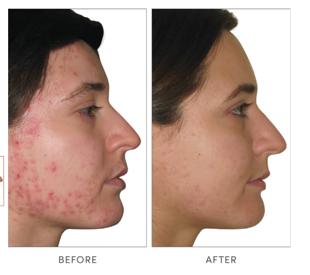 Jane Iredale Skin Accumax 14 Week Reset Box - Gabrielle's Biloxi